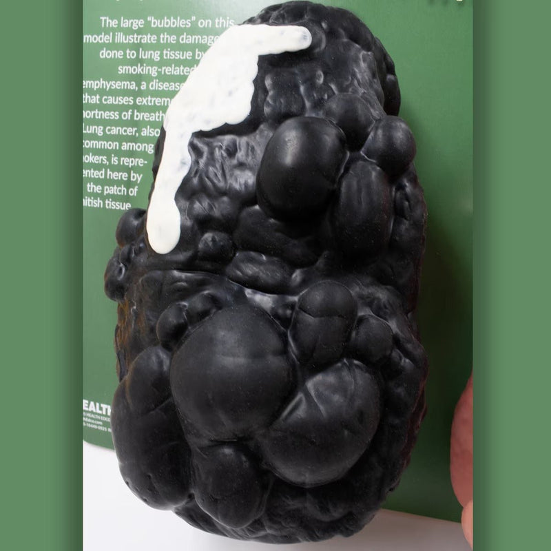 Gasping Gary™ Smoker's Lungs Comparison Model