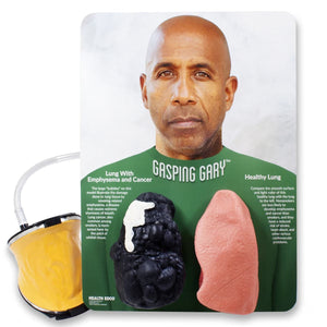 Gasping Gary™ Smoker's Lungs Comparison Model