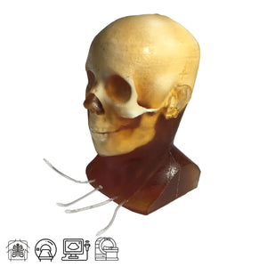 Dynamic Adult Head Phantom for Ultrasound, MRI and CT applications