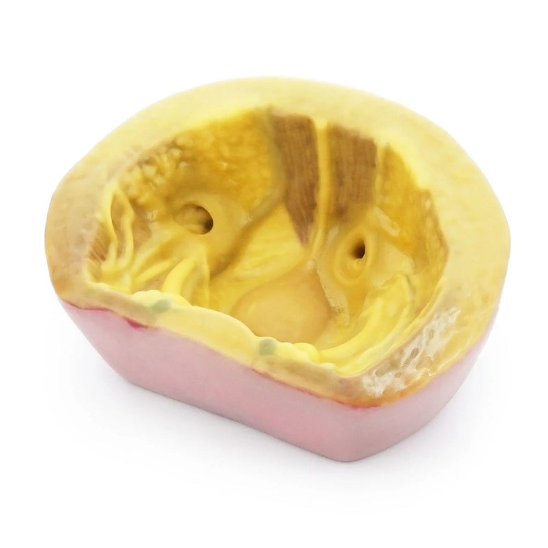 Herniorrhaphy Surgery Simulator