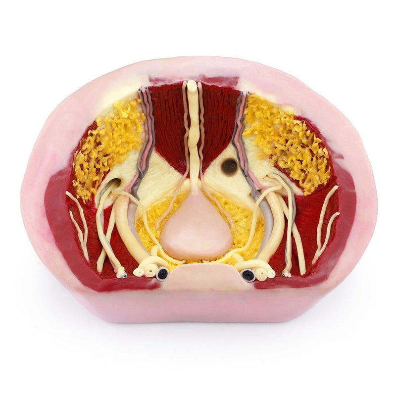 Herniorrhaphy Surgery Simulator
