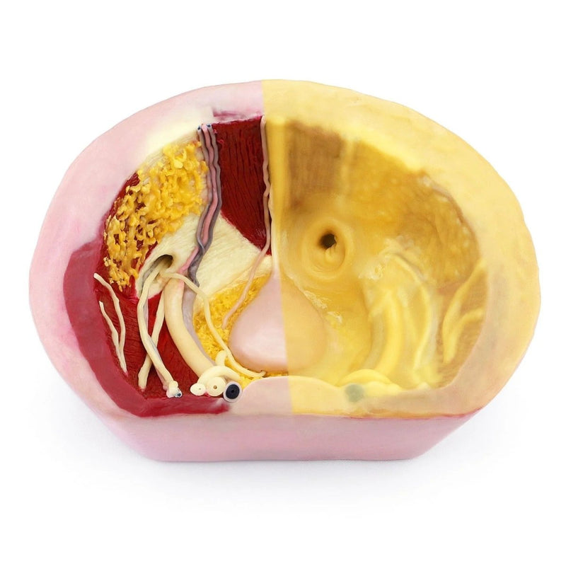 Herniorrhaphy Surgery Simulator