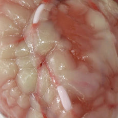 High Fidelity 2mm Native Coronaries