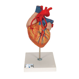 Human Heart Model with Venal Bypass, 2x life-size, 4 part
