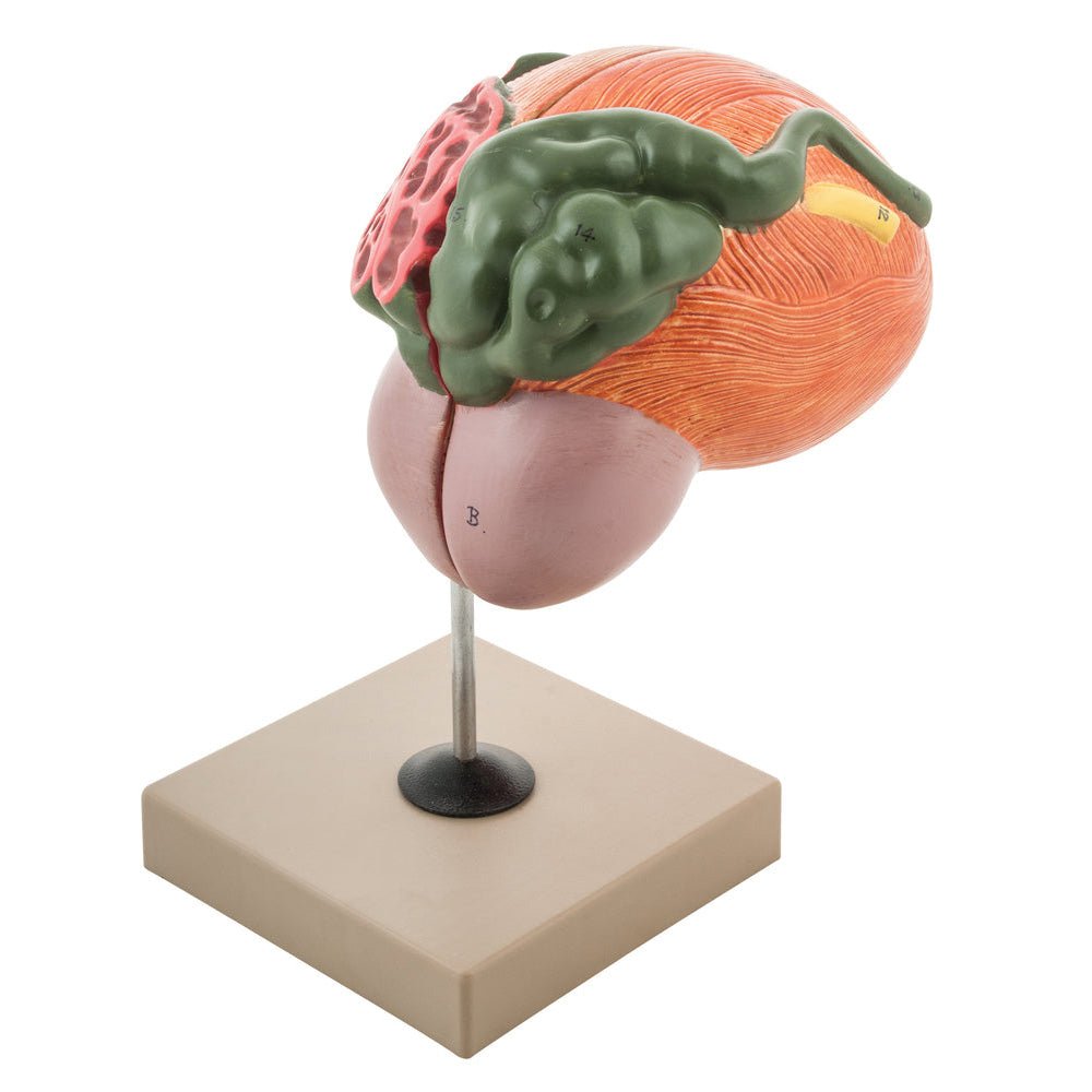 Human Urinary Bladder with Prostate Anatomical Model, 2 Parts, 3 Times ...