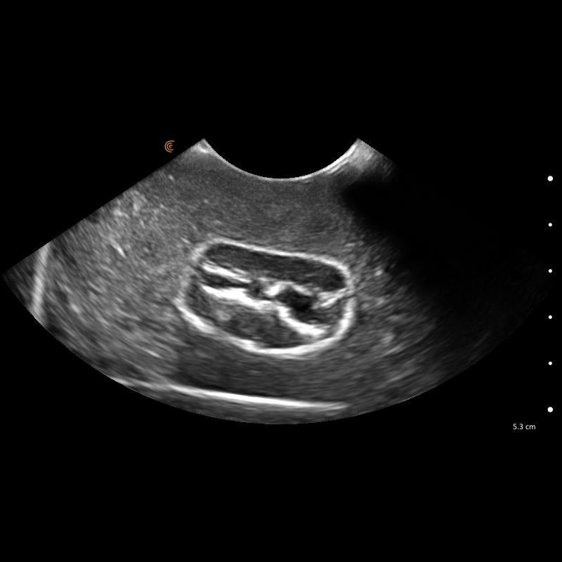 Lillie Canine Ultrasound Phantom Training Kit