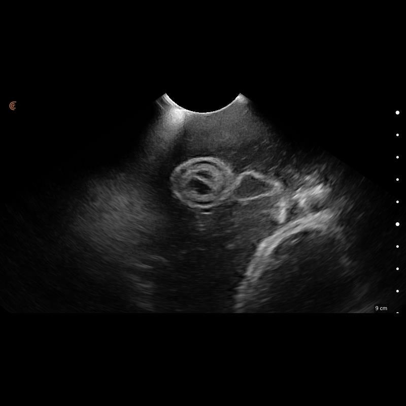 Lillie Canine Ultrasound Phantom Training Kit