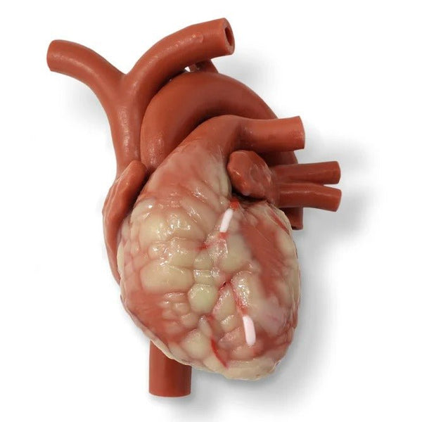 MICS Mitral CABG Beating Heart with Ancillary for MICS Thorax ...