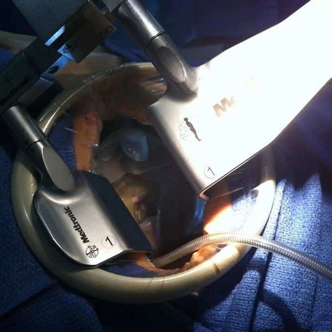 MICS Thorax