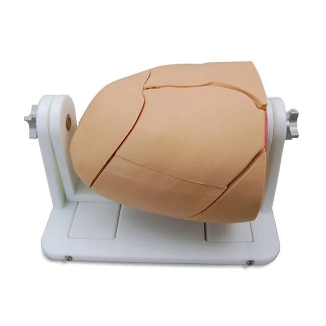 MICS Thorax