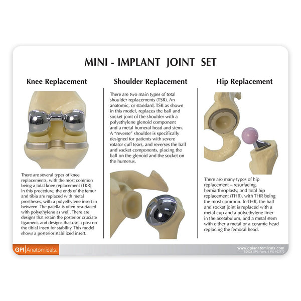 Mini Implant Joint Set – GTSimulators.com
