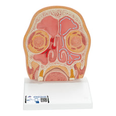 Model of Frontal Section of Human Head (paranasal sinuses)