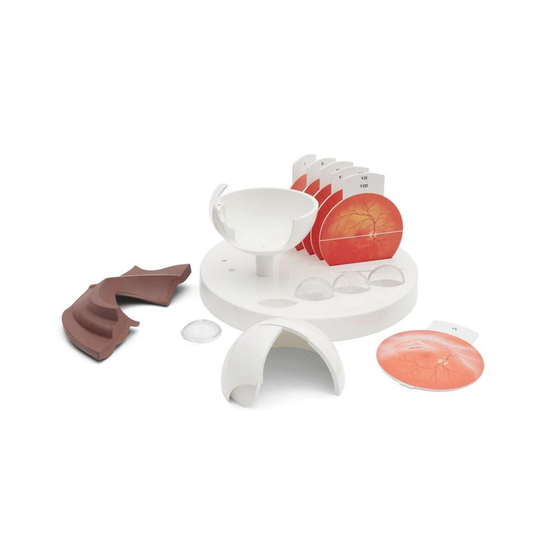 Pathological Eye Model, 5x Life-size, Dark Skin