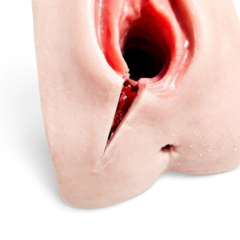 Perineal Suture Episiotomy Trainer with 2nd-3rd Degree Incisions