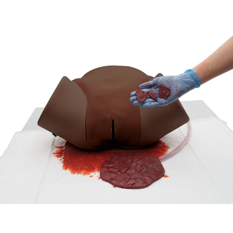 Postpartum Hemorrhage Simulator - PPH Trainer P97 PRO, Dark Skin