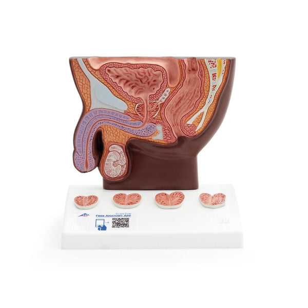 Prostate Model, 1-2 natural size, Dark Skin – GTSimulators.com