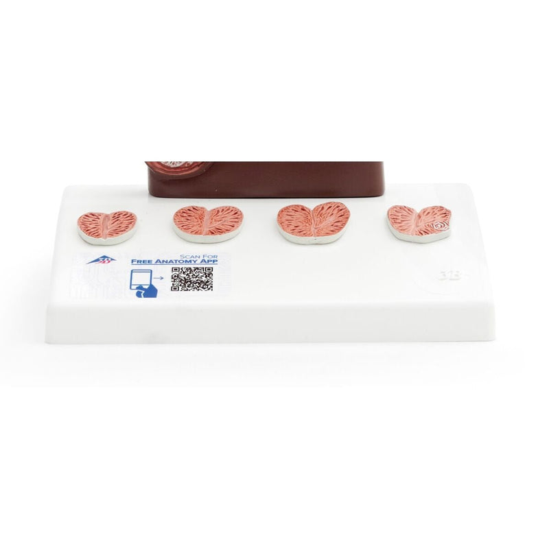 Prostate Model, 1-2 natural size, Dark Skin