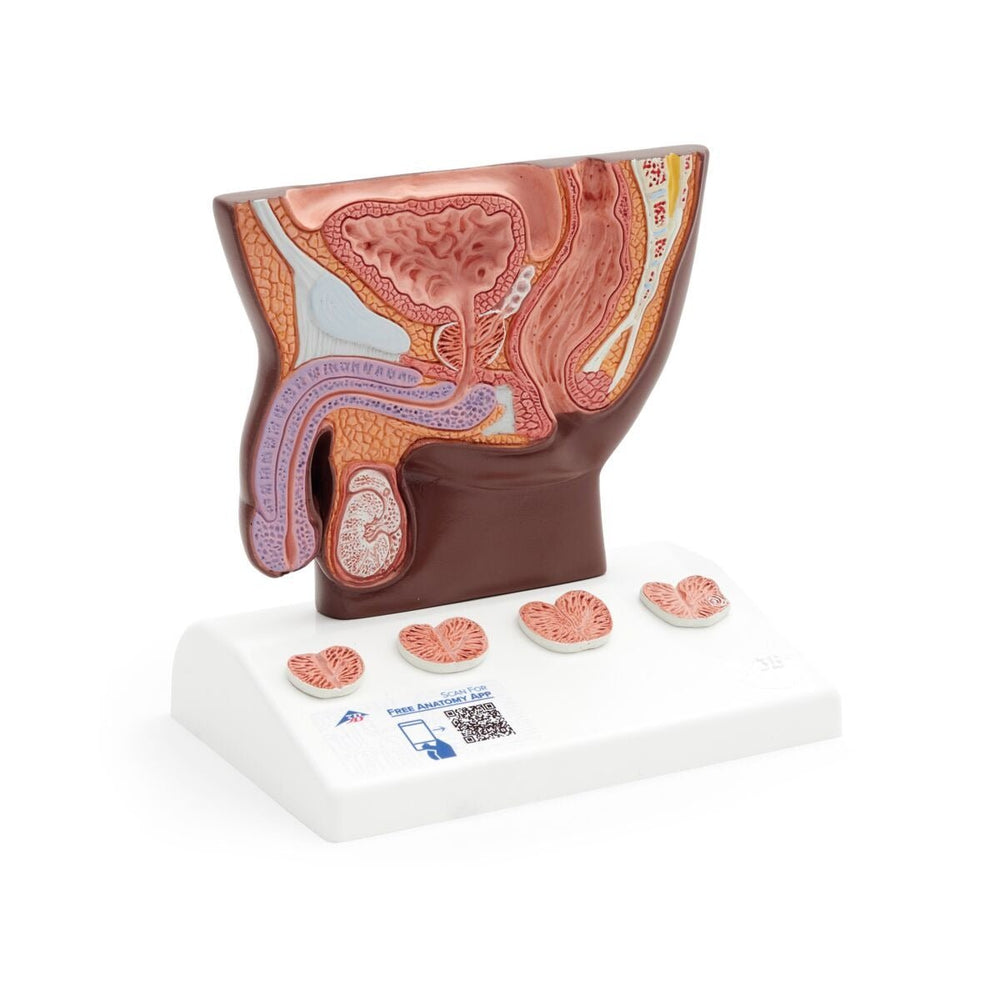 Prostate Scale Model Prostate Model, 1-2 natural size, Dark Skin – GTSimulators.com
