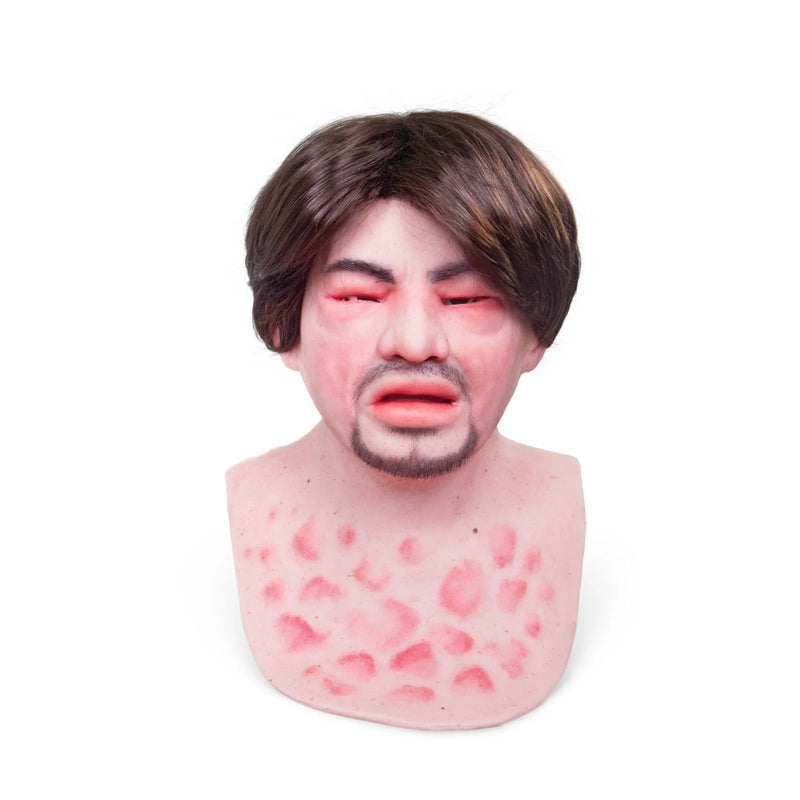 Realistic Facial Overlay 'Eduardo Anaphylaxis / stubble' for Adult Manikin Training Simulators