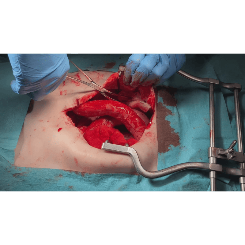 Realistic Surgical Abdominal Training Model for Medical Procedures