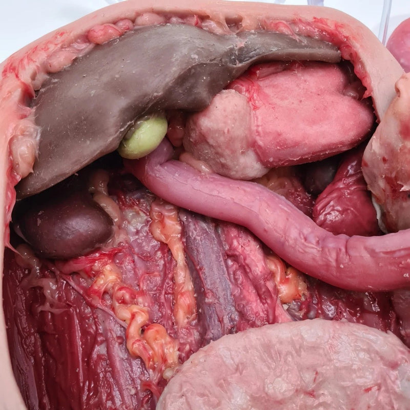 Realistic Surgical Abdominal Training Model for Medical Procedures