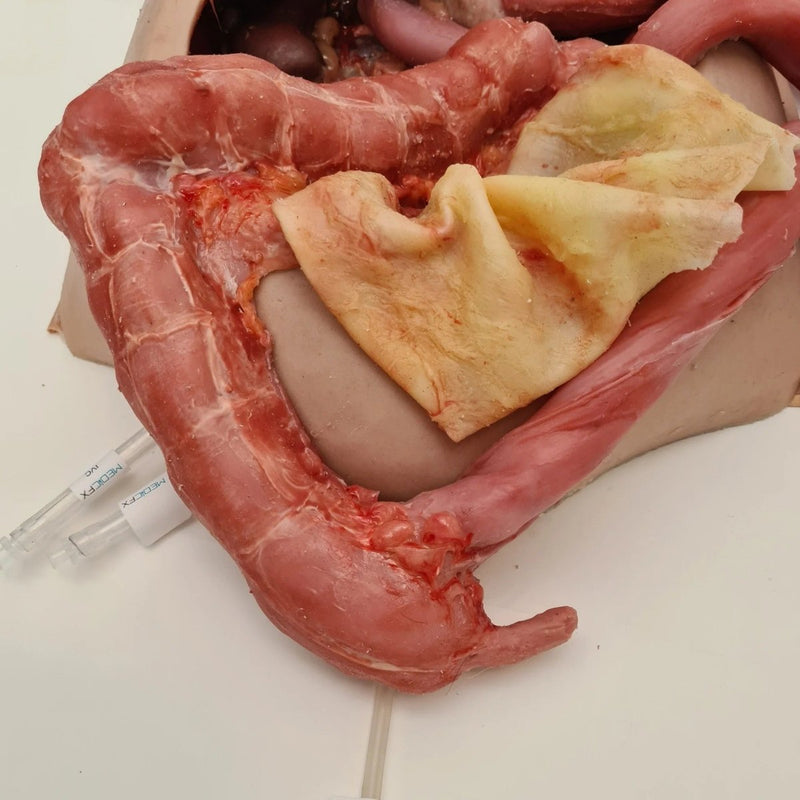 Realistic Surgical Abdominal Training Model for Medical Procedures