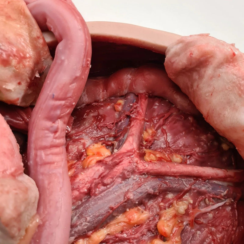 Realistic Surgical Abdominal Training Model for Medical Procedures