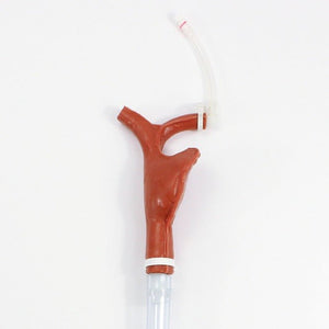 Replacement Cannulatable Right Atrium