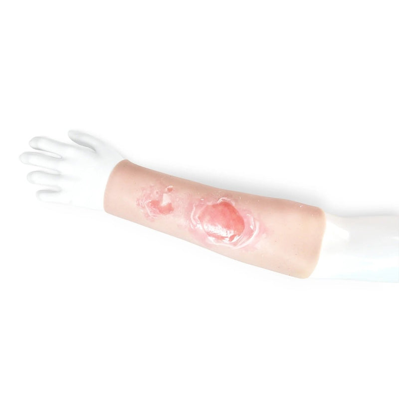 Scalding Burn Sleeve
