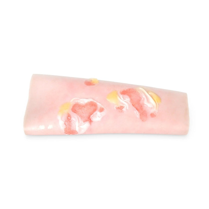 Scalding Burn Sleeve