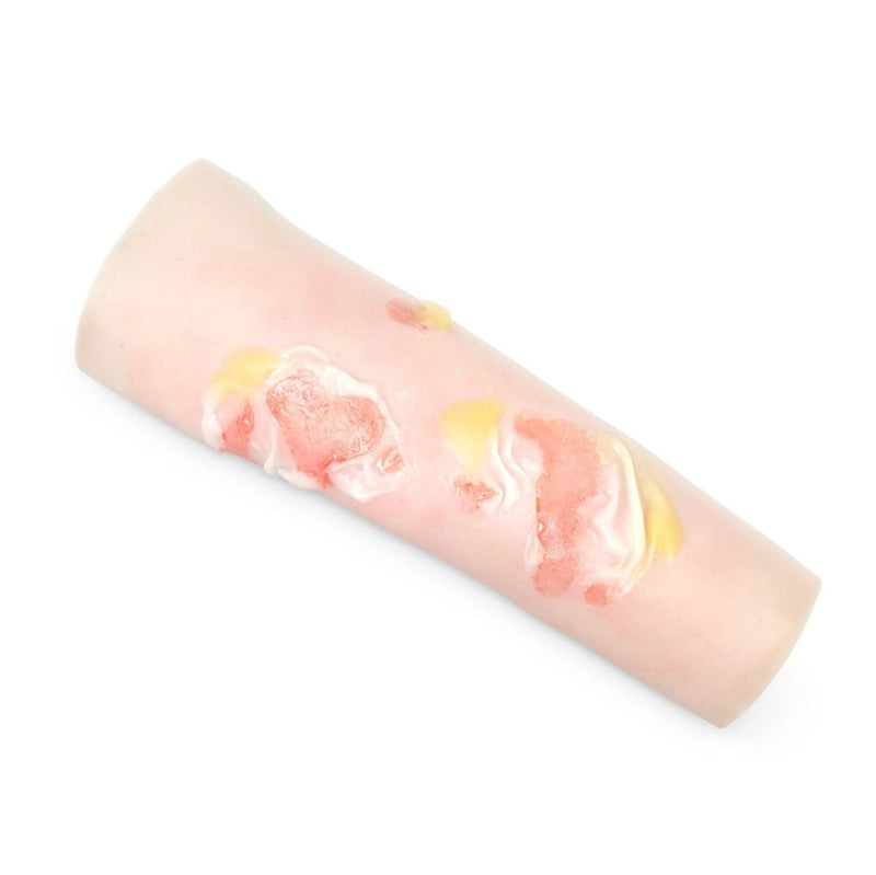 Scalding Burn Sleeve