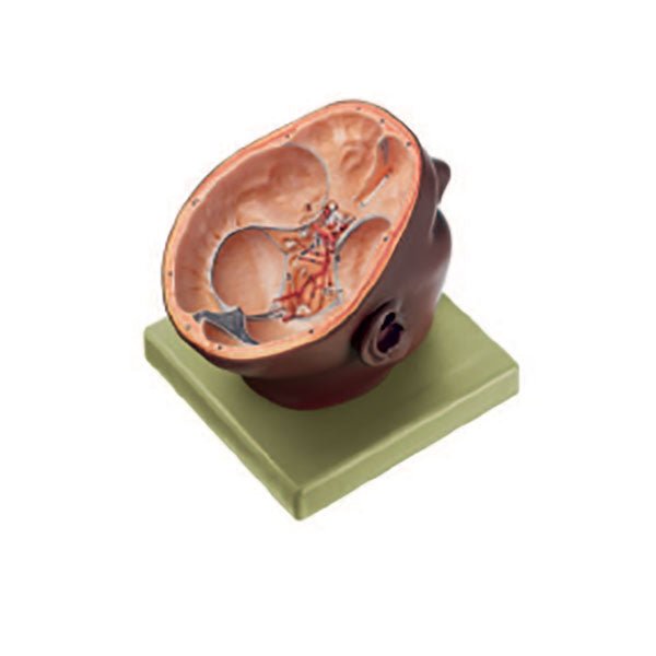 SOMSO Situs of the Base of the Skull