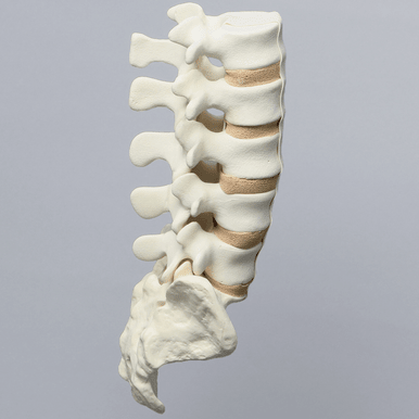 Spine, Lumbar, L1-Sacrum with Tan Discs, Solid Foam