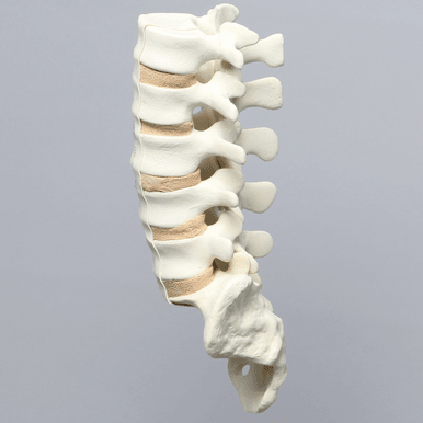 Spine, Lumbar, L1-Sacrum with Tan Discs, Solid Foam