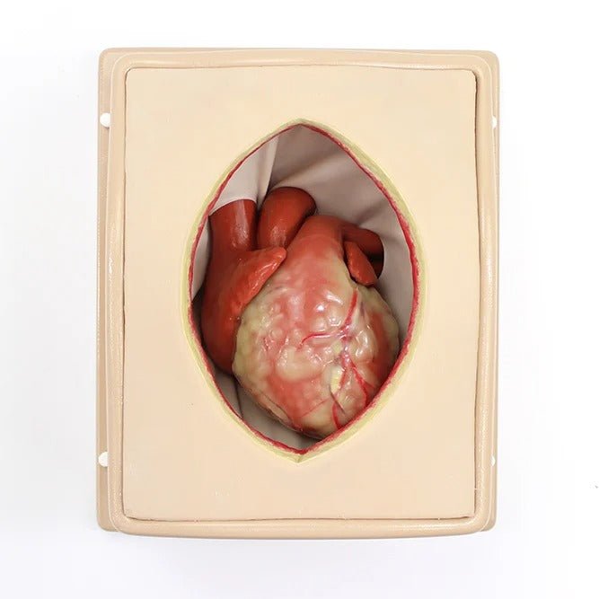 Suitcase Thorax with CABG Heart Non-Beating
