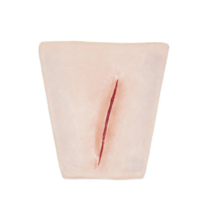 Suture Wrist laceration