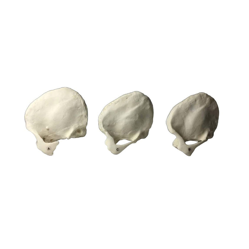 Bone Phantom Temporal Bone Phantoms for X-Ray CT, Ultrasound and MRI – GTSimulators.com