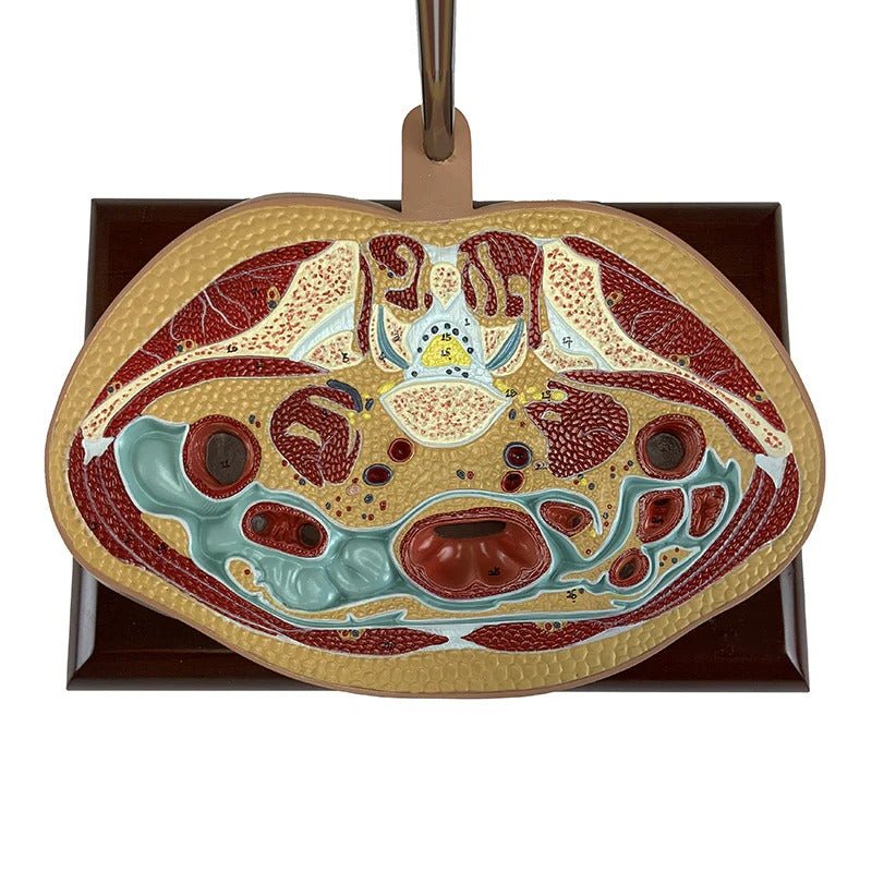 Torso Section Model, 24 Discs