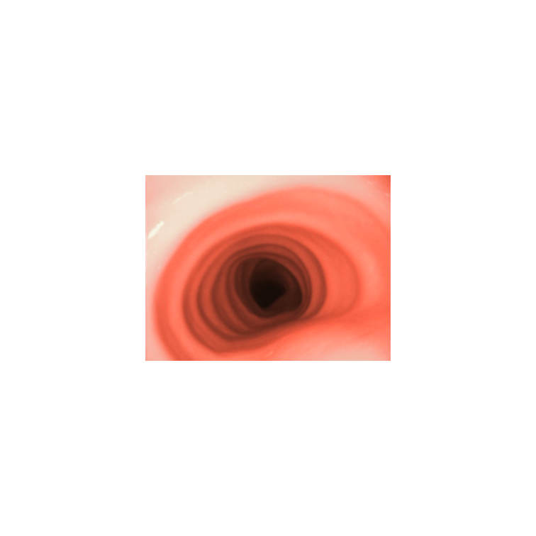 TruBaby X Lite Pediatric Basic Skills Trainer