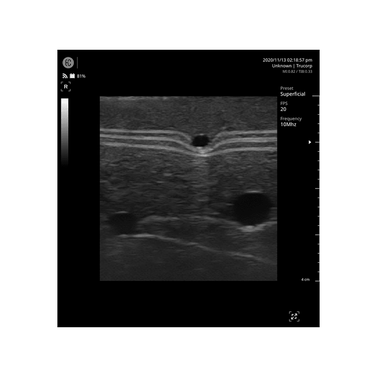 TruIV Block Ultrasound Training