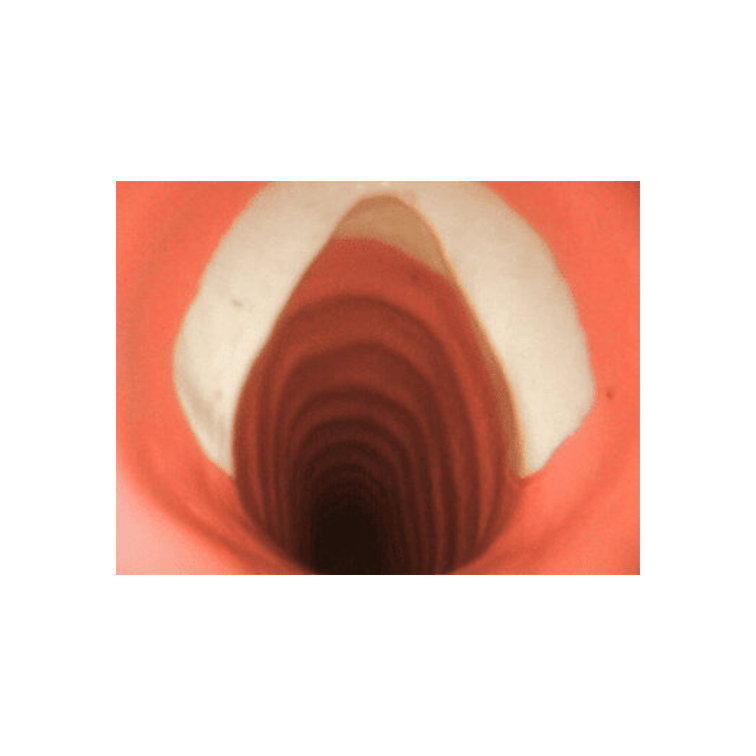 TruMan Trauma Adult Airway Management