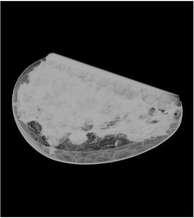 X-Ray Phantoms | Radiology Training Phantoms and Simulators ...
