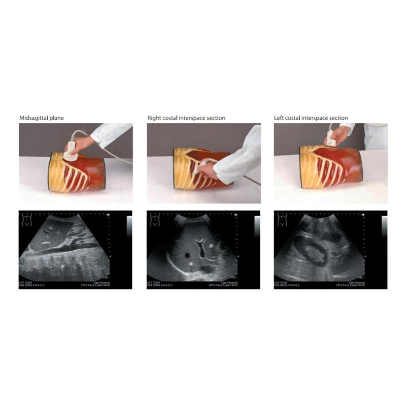Ultrasound Exam 'ABDFAN' With Pathologies, Full Set