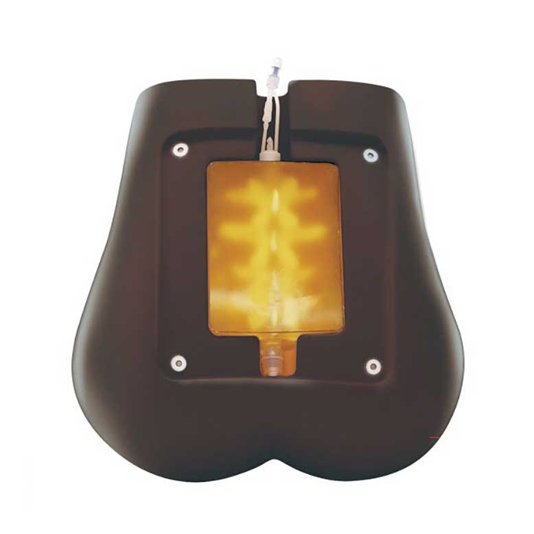 Ultrasound Lumbar Puncture Simulator