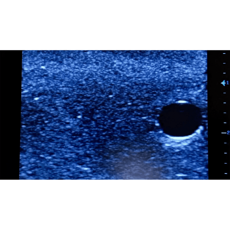 Ultrasound Simulator with 2 Branched Veins