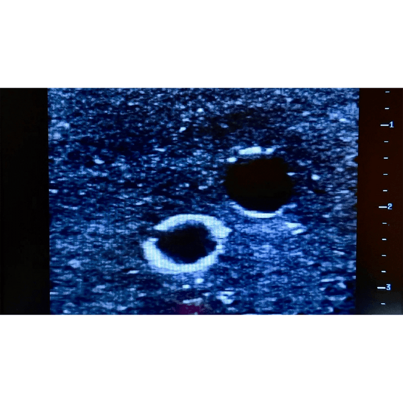 Ultrasound Simulator with 2 Branched Veins