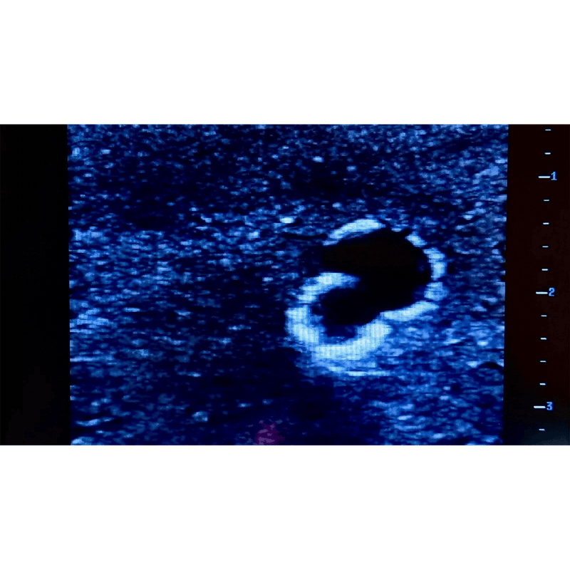Ultrasound Simulator with 2 Branched Veins