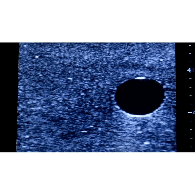 Ultrasound Simulator with 2 Central Lines