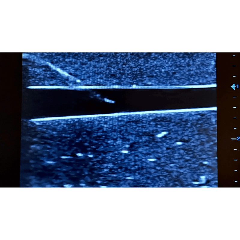 Ultrasound Simulator with 2 Peripheral Veins