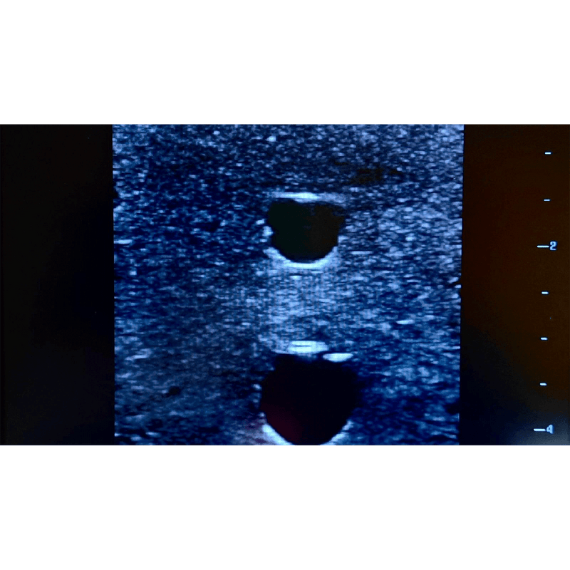 Ultrasound Simulator with 4 Central Lines